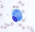 Osteoblast (Wright Giemsa stain, 100x)