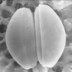 Pennate diatom(bilateral symmetry)