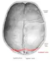 Lambdoid suture seen from inside.